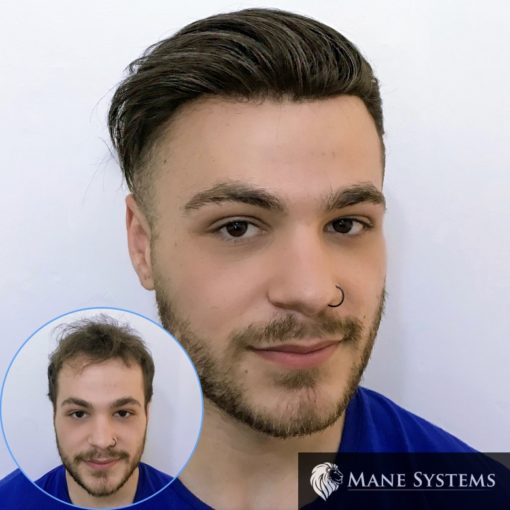 hair systems melbourne mane systems