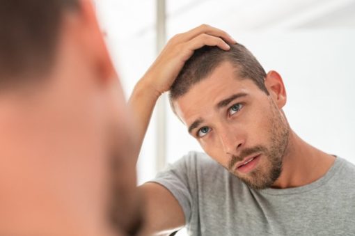 hair piece for men hair transplant alternative