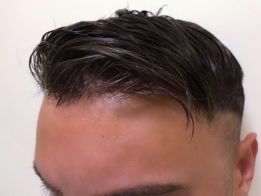A Close Look at How Detectable Hair Piece for men Are